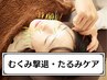 むくみ撃退＆たるみケア&歯ぎしり◎小顔美容鍼　¥10000→¥5980