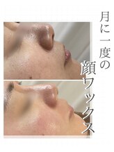 バーグトータルビューティー(bague total beauty)/月に一度の顔ワックス