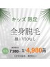 【OPEN価格】キッズ（小学生～中学生）都度払い♪全身￥７980→￥４980
