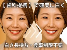 ホワイトニングセンター 沖縄コザ店