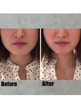 ロウエン(LAUEN)/