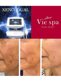 ハリツヤをUPしたい