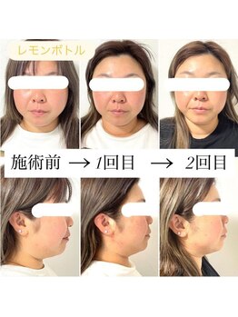 ヘアファッション ユミ(HAIR FASHION YUMI)/レモンボトル