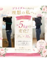 美容整体スズキ(SUZUKI)/本気のダイエット