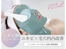 ピエル 北千住店(PIEL)の雰囲気（新導入！ニキビ、開き、凹凸毛穴改善滑らかな素肌へ導きます）