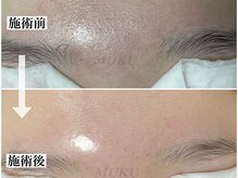 ムク(MUKU)