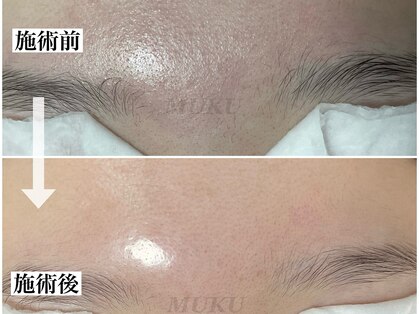 ムク(MUKU)の写真