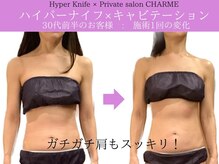 シャルム(charme)/スマホ首にハイパーナイフ