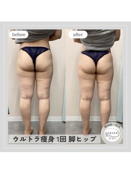 カラー(CALLA)/1回でここまで変化！