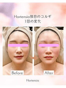 オルテンシア(Hortensia)/コルギ☆ビフォーアフター