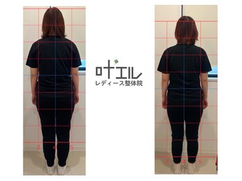 叶'エル 本町 心斎橋院/姿勢改善　骨盤矯正