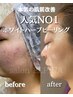 平日10～14時までにご来店限定・大人気ホワイトハーブピーリング￥7,800→