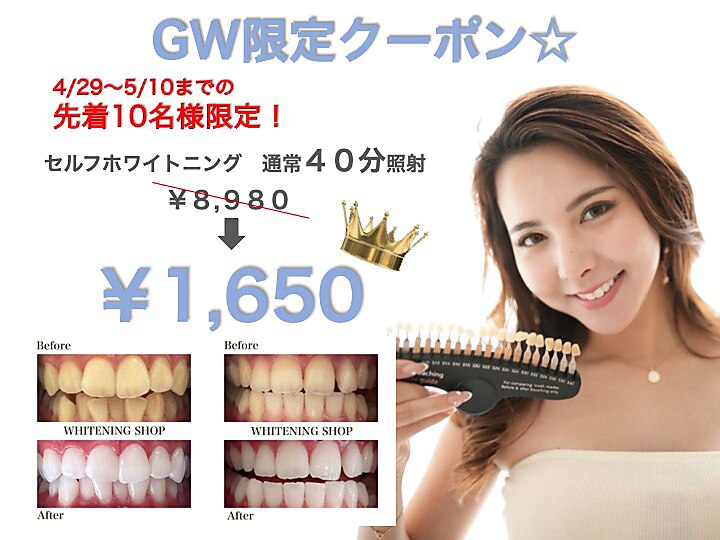 セルフホワイトニング 効果ある？】チョコザップのセルフホワイトニングを徹底解説｜使い方