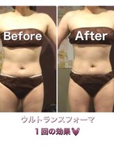 サロン ド マナ(Salon de Mana)/ウルトランスフォーマー全身ケア