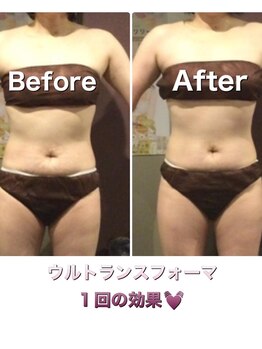 サロン ド マナ(Salon de Mana)/ウルトランスフォーマー全身ケア