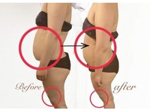 グロワール(gloire)/◇BeforeAfter◇