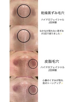 フォルチェ 三川町(Folche)/《フェイシャル》