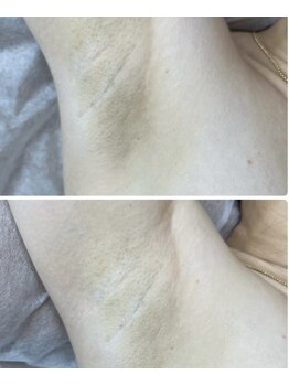 ルルアス(LuLu AS)/夏前にララシークレット