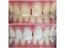 ホワイトニングルーム 横浜店(Whitening Room)/ホワイトニング/横浜