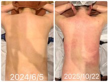 スピード美人 本八幡店/数回でも効果あり、継続で激変