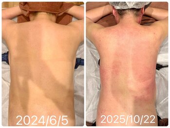 スピード美人 本八幡店/数回でも効果あり、継続で激変