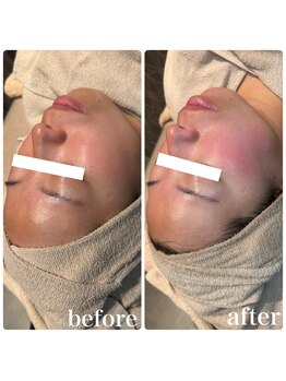 ディオーネ 春日井勝川店(Dione)/マーメイドセルトリートメント