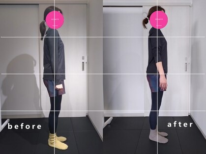 インプルーバー(improver)の写真