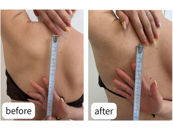 アーユス(AYUS)/リンパマッサージ・BeforeAfter