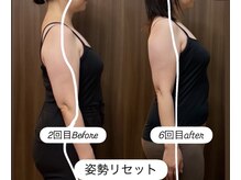 グラースア(grace a)の雰囲気（骨、筋肉//姿勢、ボディライン、こり、ストレス、巡り、）