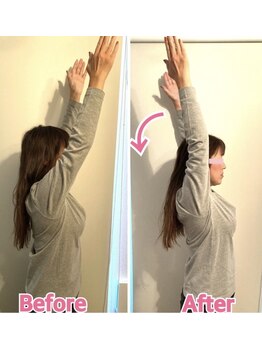 クオコア(KUOKOA)/Before/After