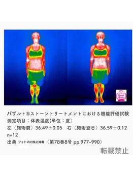 セラフ(Seraph)/温活効果有り