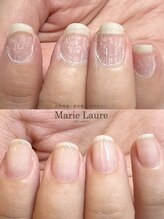 マリーロール 梅田店(Marie Laure)/自爪育成/深爪矯正/ネイルケア