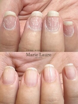 マリーロール 梅田店(Marie Laure)/自爪育成/深爪矯正/ネイルケア