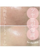 ルシェリア(Le cherien)/REVIハーブピーリング