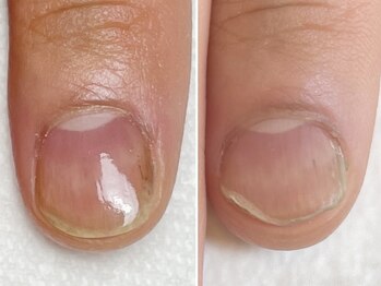 コフズ(Kofz)/美爪育成経過