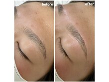 シュ シュ(chou chou)/眉スタイリング before/after