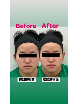 ゆうはり鍼灸整骨院 恵比寿/お客様Before　After