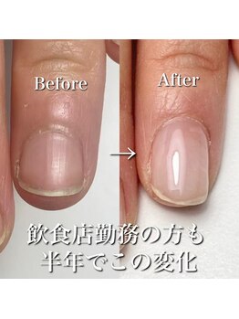 リリー/飲食店で働くお客様も自爪育成