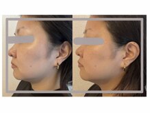 ソラ(sola*)/レモンボトル