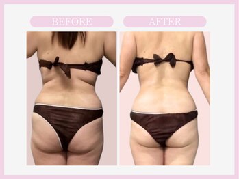 スリムライン 山形店(The Slim Line)/before→after