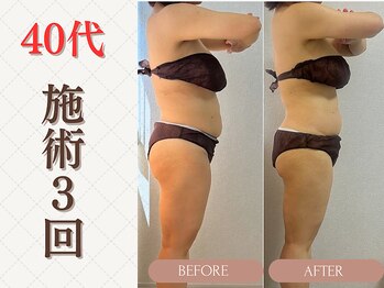 ミヨンビー(miyong.B)/