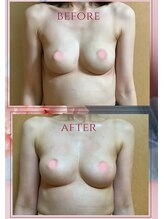 アップオー 小倉店(up・O)/体験者様、施術例