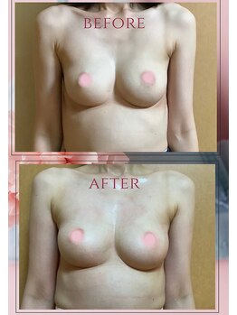 アップオー 小倉店(up・O)/体験者様、施術例