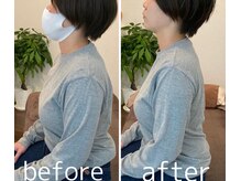 クオコア(KUOKOA)/Before/After