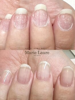 マリーロール 梅田店(Marie Laure)/自爪育成/深爪矯正/ネイルケア