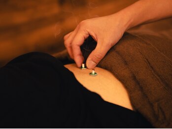 リフージ 大岡山院(RE.FUGE)/お灸