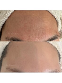 ルブドワール(Le Boudoir)/30代お客様before→after