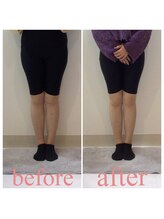 スタイルラボ高松/産後骨盤矯正の効果