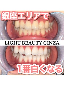 ライトビューティー 銀座店(LightBeauty)/３色LEDマシンでホワイトニング