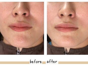 シフク鍼灸整体院/30代女性(加工なし)